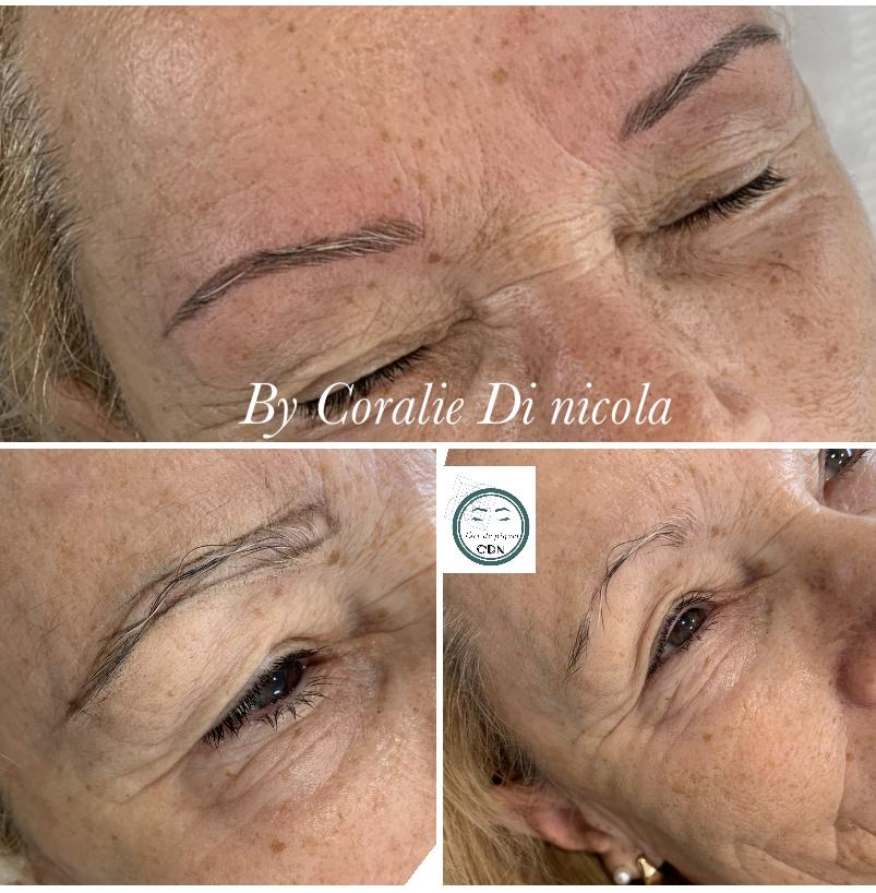 Restructuration sourcils en dermo